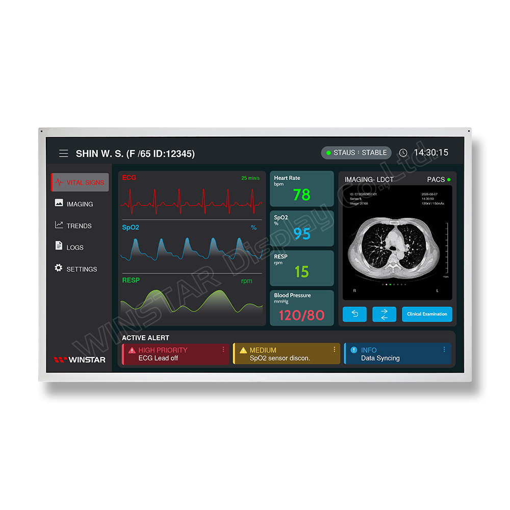 21.5 inch HDMI TFT 1920x1080